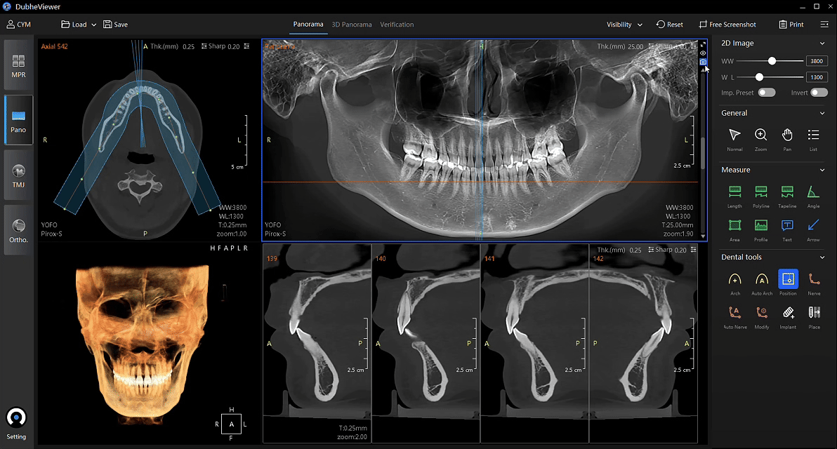 YOFO imaging report editor